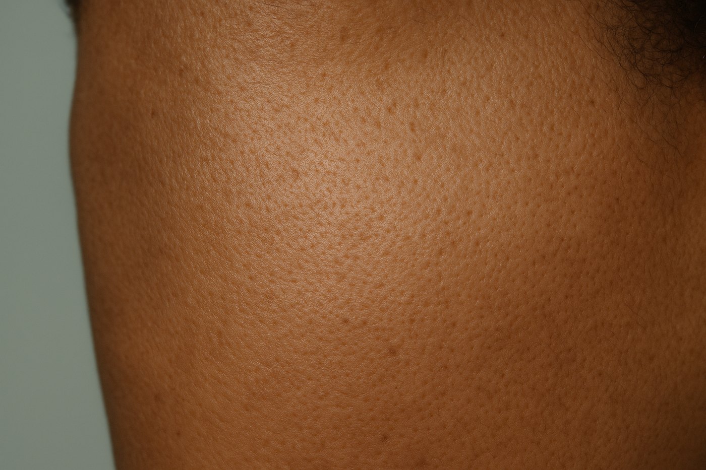 Straight-on macro of the cheek and temple of a woman with deep brown skin in soft even daylight, fine natural skin texture and pores across the frame, sage background