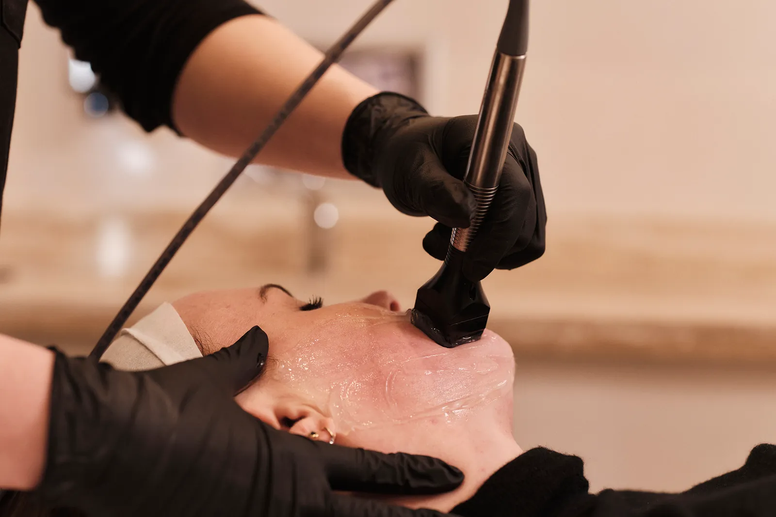 A radiofrequency handpiece being guided along the jawline during an InMode Contoura treatment at Facial Sculpting in South Kensington