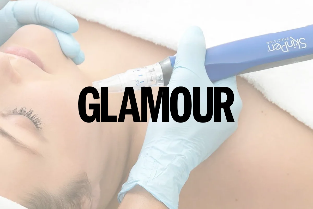 Glamour masthead over a SkinPen microneedling treatment at Facial Sculpting